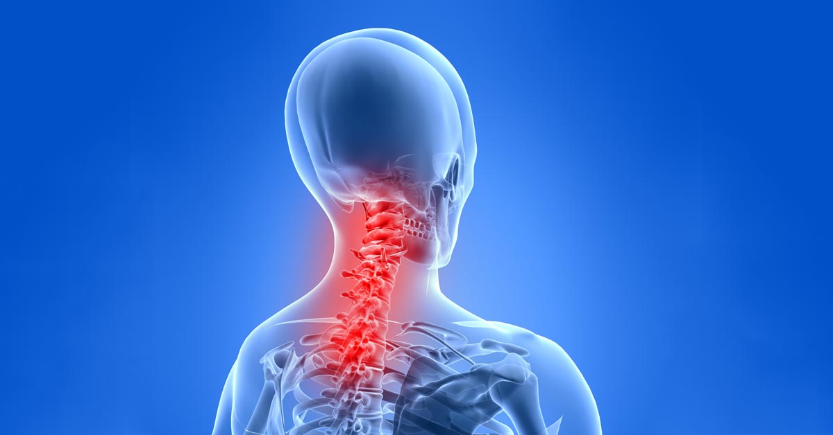 Texarkana car accident and neck pain treatment